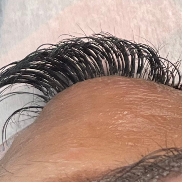 Adhesive Max, after 2 weeks